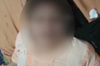 Acid Attack on house wife