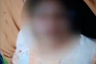 acid attack on a woman in maldah