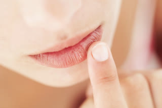 What can cause hyperpigmentation of the lips?