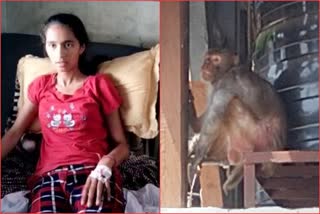 Monkey attack on girl in mandi