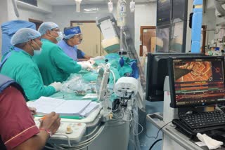 OCT Based Cardiac Procedure at Ambedkar Hospital