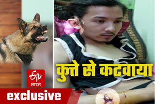 youth of Dehradun was bitten by dog