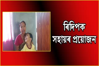 specially-abled-child-from-jonai-need-help-from-himanta-biswa-sharma