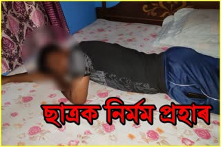 student-of-jnv-brutal-torture-at-kokrajhar-in-chirang