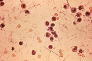 ഷിഗല്ല ബാധ  ചെറുവത്തൂര്‍ ഷിഗല്ല ബാധ  shigalla  shigalla bacteria