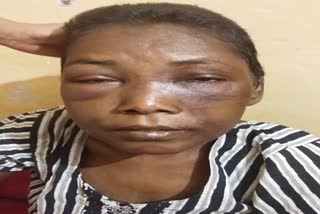 accused-of-beating-and-cutting-hair-with-domestic-help-police-filed-case-against-businessman-and-his-wife