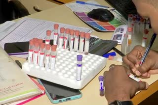 children having Thalassemia tested HIV positive