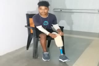 artificial limbs transplant to the paralyzed people in capital hospital