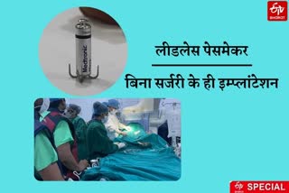 ghaziabad leadless pacemaker