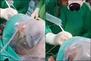 What if my brain is opened up  let me sing a song; video of a live surgery goes viral  തലച്ചോര്‍ ശസ്‌ത്രക്രിയയ്‌ക്കിടെ രോഗിയുടെ പാട്ട് വൈറല്‍  തലച്ചേര്‍ ശസ്‌ത്രക്രിയയ്‌ക്കിടെ ഗുലാം അലിയുടെ ഹംഗാമ ക്യോൻ ബാപ്ര രഹേ ഹോ പാട്ട് പാടി രോഗി  viral song of patient during brain surgery in rayipur