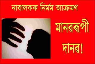 অমানৱীয়! নাবালকক ফেনত ওলোটাই গৰম লোৰ ৰ'ডেৰে প্ৰহাৰ, মুখ্য অভিযুক্তক আটক