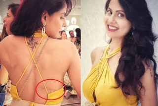chhavi Mittal oozes glamour in yellow gown post breast cancer surgery