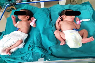 After giving twins birth in Surat, why did the woman leave the hospital so abruptly?