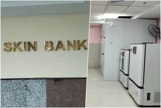 Skin Bank In Rajasthan