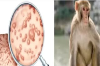 मंकीपॉक्स , who on monkeypox