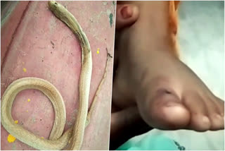 Cobra dies after biting 4 year old boy  Cobra dies after biting  gopalganj Cobra dies  നാല് വയസുകാരനെ കടിച്ച പാമ്പ് ചത്തു  നാല് വയസുകാരനെ കടിച്ചശേഷം പാമ്പ് ചത്തു