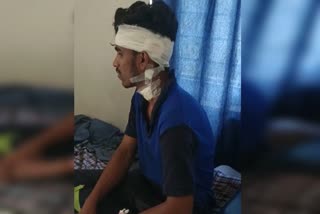 A drunken man assaulted on Hubli bar staff