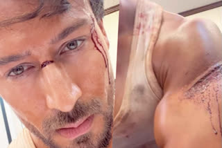 tiger shroff injured