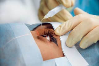 Do not ignore cataract