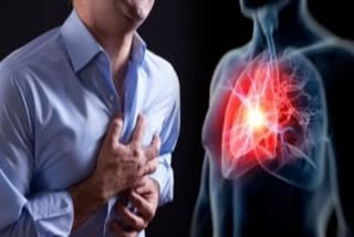 What are the causes of heart pain, heart attacks at the age of 30?