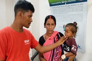 Life saving factor 9 not available for Hemophilia patients at RIMS in Ranchi
