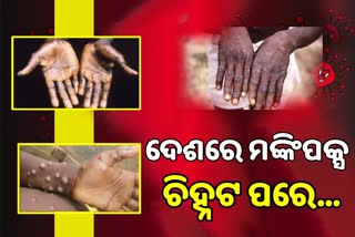 Monkeypox: କେରଳରେ ପ୍ରଥମ ମାମଲା ଚିହ୍ନଟ, ଜାଣନ୍ତୁ କେମିତି ରହିବେ ସତର୍କ