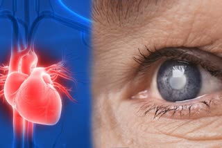 is there connection between eye disease and heart diseases