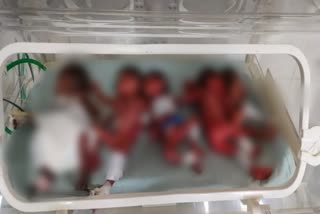 Woman gave birth to five children in Karauli