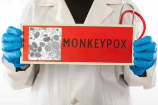 Suspected patient of Monkeypox found in Chhattisgarh