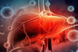 World Hepatitis Day: Know the types of Hepatitis, symptoms and precautions