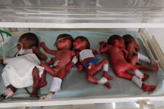 Five Children Birth Case