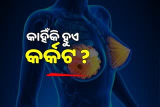 ପୁରୁଷଙ୍କ ଅପେକ୍ଷା ମହିଳାଙ୍କୁ ହୋଇଥାଏ ଅଧିକ କର୍କଟ ରୋଗ: ଅଙ୍କୋଲୋଜିଷ୍ଟ