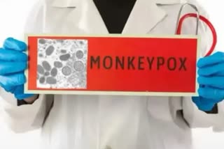 First deaths reported from Monkeypox in Spain and Brazil outside Africa