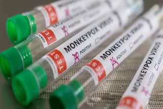 monkey pox kerala  punnayur thrissur monkey pox death  പുന്നയൂര്‍ പഞ്ചായത്തില്‍ ജാഗ്രത  മങ്കി പോക്‌സ് സ്ഥിരീകരിച്ചയാളുടെ മരണം  തൃശൂർ മങ്കി പോക്‌സ് മരണം  മങ്കി പോക്‌സ് മരണം കേരളത്തിൽ