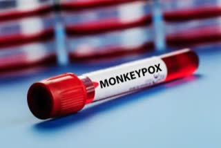 Monkeypox symptoms