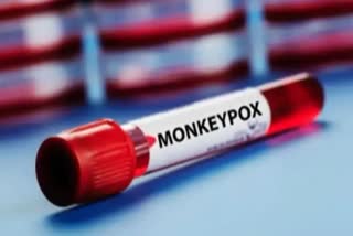 Monkeypox: କେରଳରେ ନୂଆ ମାମଲା ଚିହ୍ନଟ, ୫କୁ ବଢିଲା ଆକ୍ରାନ୍ତଙ୍କ ସଂଖ୍ୟା