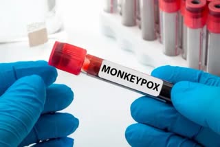 monkeypox case
