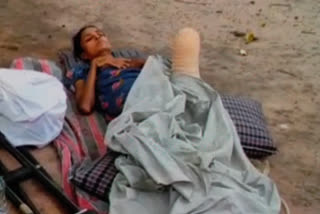 man from Palamu cut off his wife leg