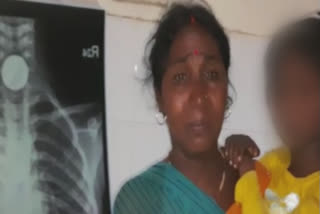 Re two coin stuck in child's neck in Bihar's Nalanda district