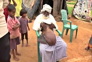 huge-tumor-on-stomach-of-old-man-in-gadag