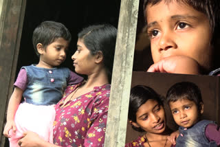 Seeking treatment help  ajeesha Seeking treatment help  ജന്മനായുള്ള തിമിരം  അജീഷ  യൂണിയന്‍ ബാങ്ക് ഓഫ് ഇന്ത്യ നെടുങ്കണ്ടം  idukki ajeesha  കേരള വാര്‍ത്തകള്‍  പുതിയ വാര്‍ത്തകള്‍  ഇന്നത്തെ വാര്‍ത്തകള്‍  ഇടുക്കി വാര്‍ത്തകള്‍  kerala latest news  kerala latest news  latest malayalam news today  malayalam news today  malayalam news live  kerala malayalam news live