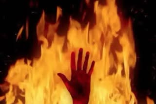 Mathra woman sets her husband ablaze