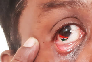75th Independence Day: Miniature artist paint flag in his eye