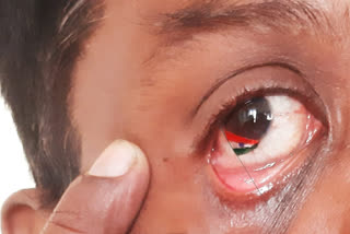 Indian Flag  Indian Flag painted on Eye  Miniature artist paint Indian flag in his eye  കണ്ണില്‍ ദേശീയ പതാക വരച്ചുചേര്‍ത്ത് കലാകാരന്‍  എഴുപത്തിയഞ്ചാം സ്വാതന്ത്ര്യദിനത്തിന്‍റെ ഭാഗമായി കണ്ണില്‍ ദേശീയപതാക വരച്ചുചേര്‍ത്ത് മിനിയേച്ചര്‍ കലാകാരന്‍  കോയമ്പത്തൂര്‍ കുനിയമുത്തൂര്‍  Tamilnadu News  Latest Coimbathore News  Coimbathore  Kuniyamuthur  എഴുപത്തിയഞ്ചാം സ്വാതന്ത്ര്യദിനത്തിന്‍റെ ഭാഗമായി കണ്ണില്‍ ദേശീയപതാക