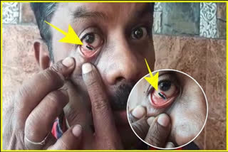 man Painted National Flag in Eye