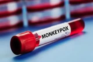 Monkeypox ଉପରେ ଅନୁସନ୍ଧାନକାରୀଙ୍କ ସତର୍କ ବାଣୀ, ଅବହେଳା ବିଶ୍ବସ୍ତରରେ ସୃଷ୍ଟି କରିପାରେ ସମସ୍ୟା