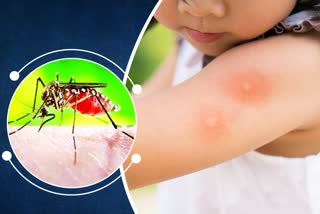 dengue-fever-in-children-precautions