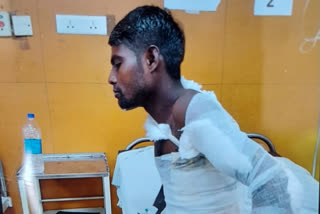 Attempt to burn person by petrol