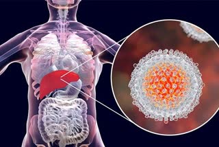 life threatening disease hepatitis types Hepatitis symptoms
