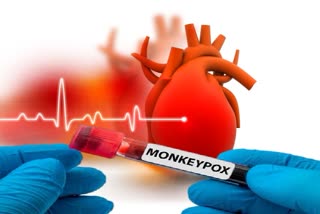 Monkeypox ହୃଦୟ ମାଂସପେଶୀ ପ୍ରଦାହ ସୃଷ୍ଟି କରିପାରେ !